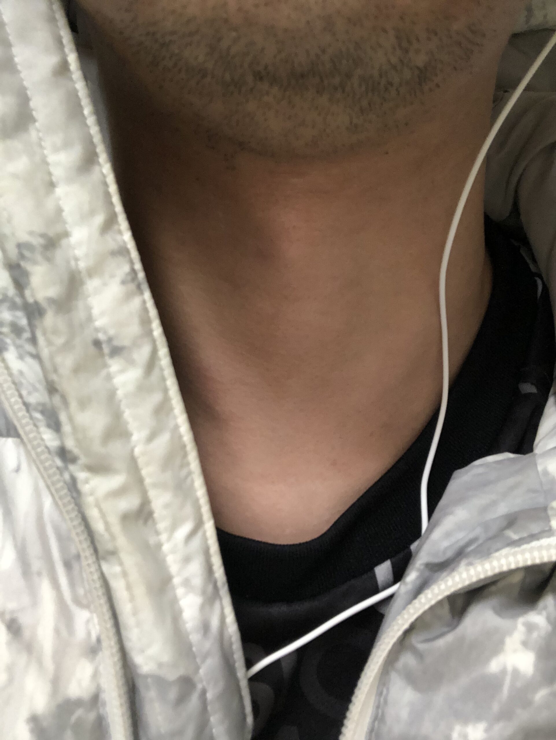 脱毛前顎髭の画像